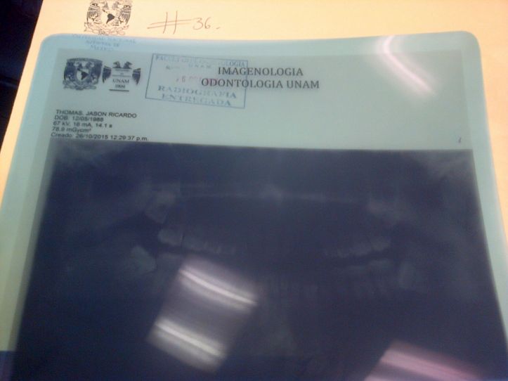 AmvhhCoWOhrw-tnyauMa8yKMresWrBEi_RJAkqF88r2X